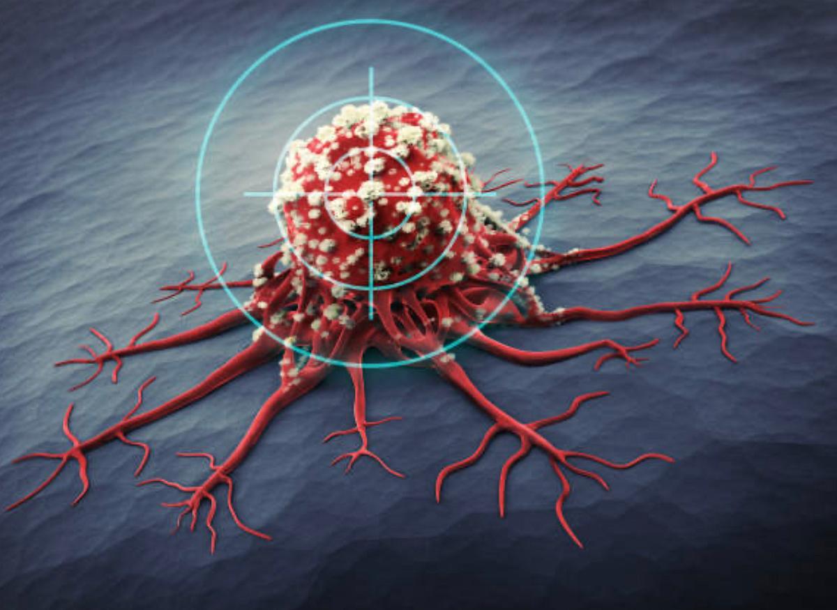 புற்றுநோய்