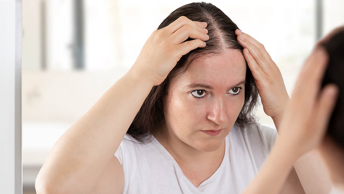 'ஆண்ட்ரோஜெனடிக் அலோபேஷியா' (Androgenetic alopecia) எனப்படும் ஒருவகை வழுக்கை 40 வயதுக்கு மேலான பெண்களில் 50 சதவிகிதம் பேரை பாதிக்கிறது.