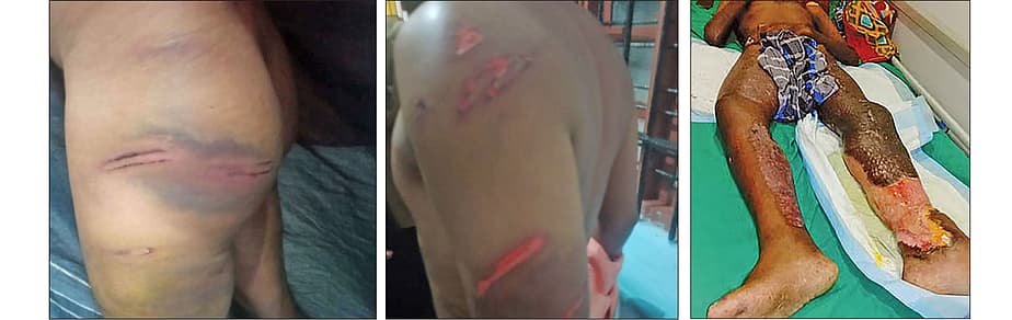 அஜித்குமார் மீது தாக்குதல்