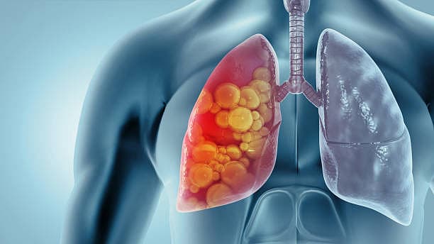 சுவாச நோய்கள்