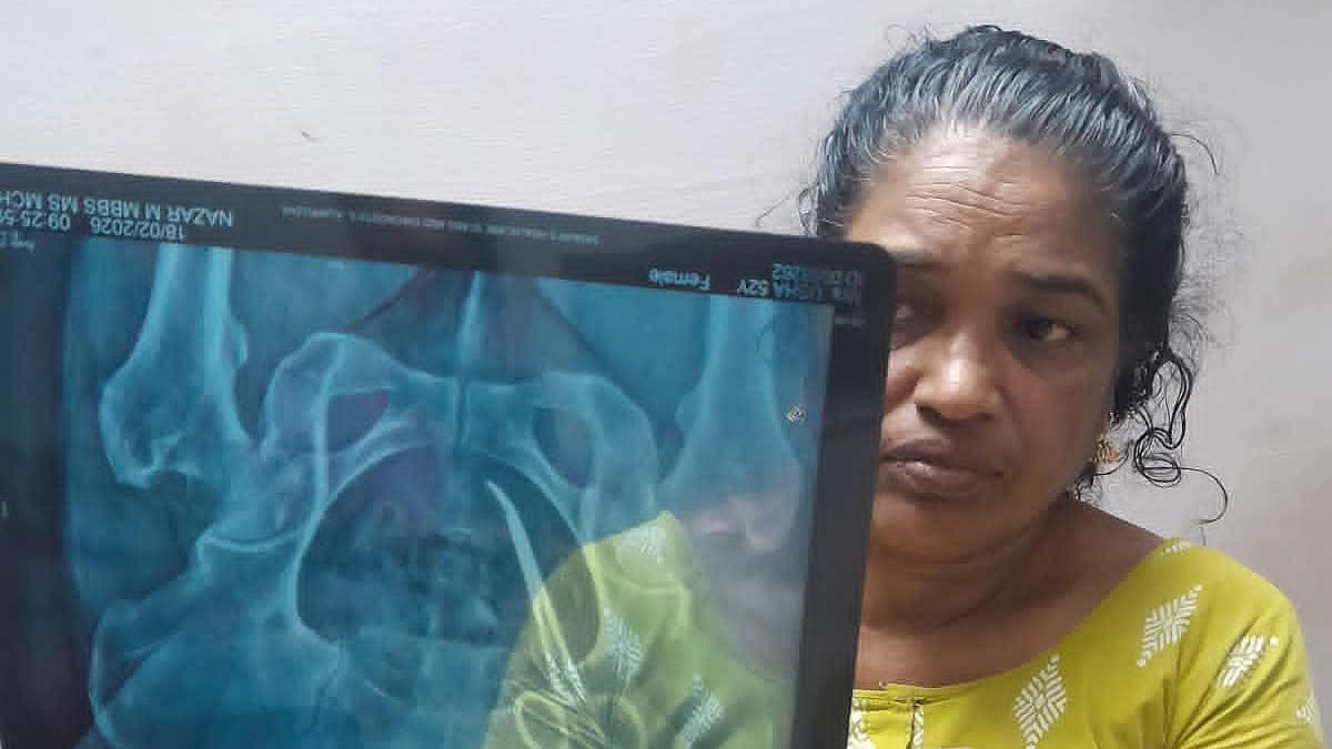 மூதாட்டி வயிற்றில் இருக்கும் கத்தரிகோல்