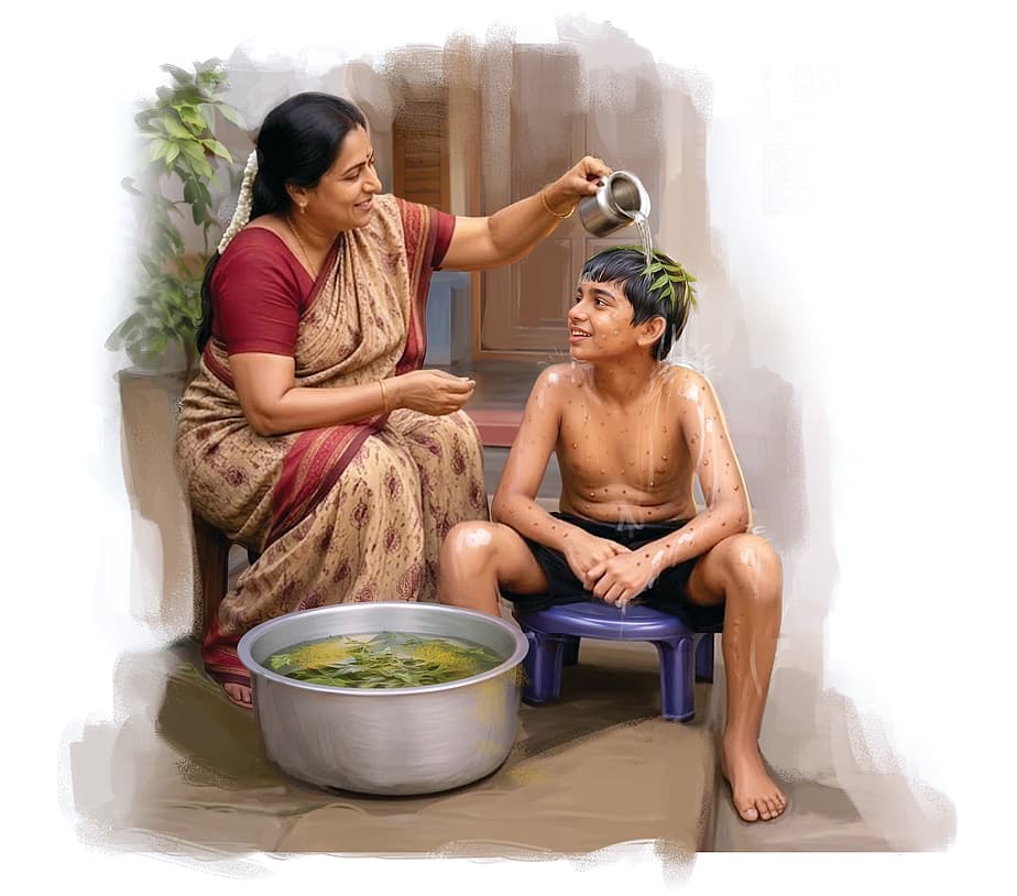 அம்மை - சிறுகதை!